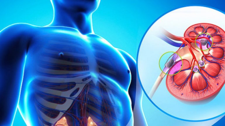 Οι καρδιακές παθήσεις έχουν επιπτώσεις στους νεφρούς